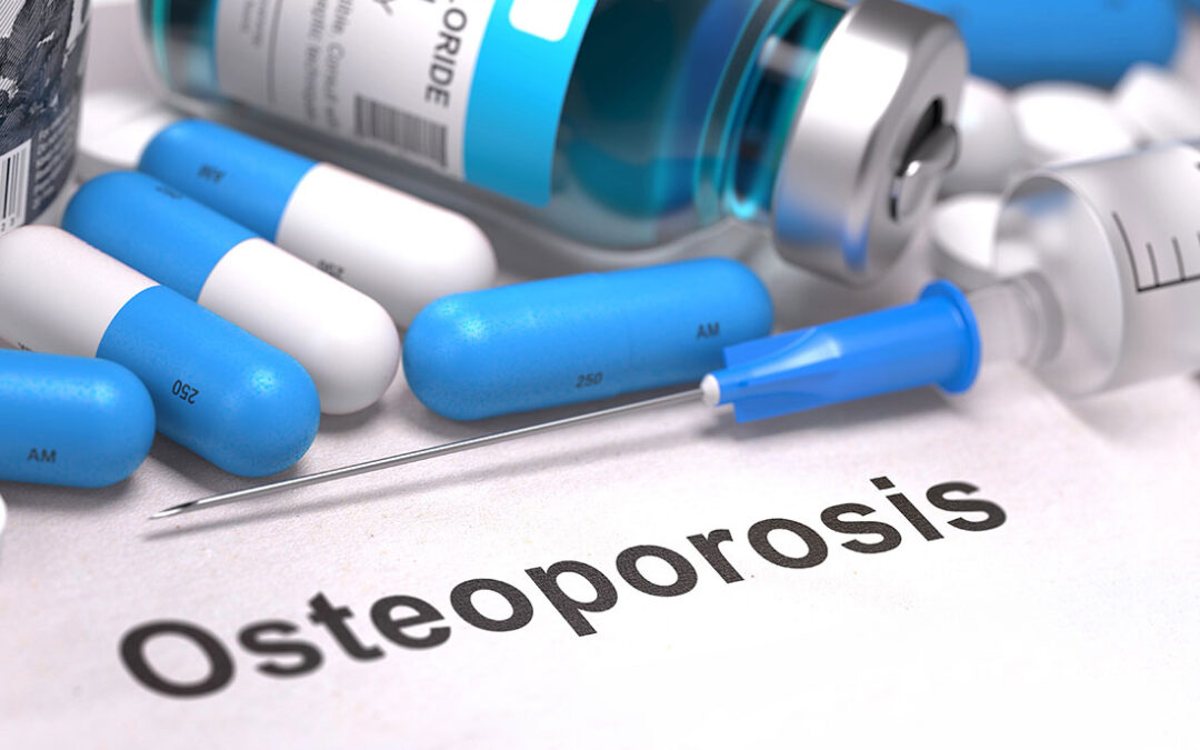 Osteoporosis. Cuida tus huesos para ganar calidad de vida